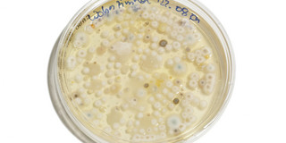 Petrischale mit Bakterienkultur